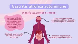 Gastritis atrófica autoinmune A propósito de un caso [upl. by Wymore]