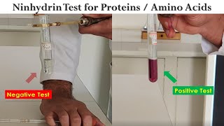 Ninhydrin Test [upl. by Lenhard476]