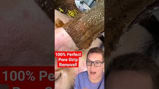 😍 Perfect PORE STRIP REMOVAL shorts [upl. by Dnomsaj852]