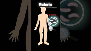 Malaria amp life cycle of plasmodium 🦟 neetbiology humanhealthanddisease neet pw viralshorts [upl. by Sil]