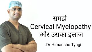 समझे Cervical Myelopathy और उसका इलाज [upl. by Enyad]