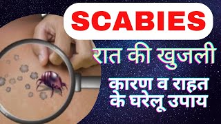 स्केबीज़ रात की खुजली क्या है  scabies in hindi  scabies home treatment  itching in night [upl. by Ilrebmik]