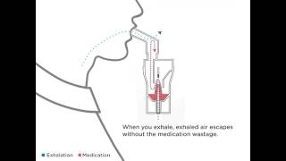 Omrons Virtual Valve Technology VVT [upl. by Ty]