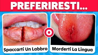 Preferiresti 100 SCELTE PIÙ DIFFICILI DI SEMPRE 😱😨 [upl. by Hak43]