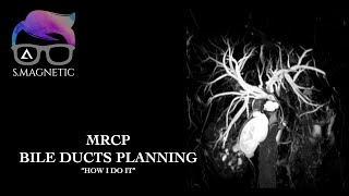 MRCP BILE DUCTS PLANNING quotHOW I DO ITquot [upl. by Hamon]