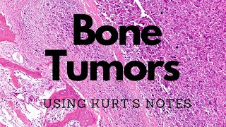 Bone Tumors Kurt’s Notes pathagonia [upl. by Serica54]