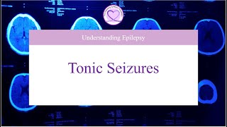 What are Tonic Seizures [upl. by Ailhat]