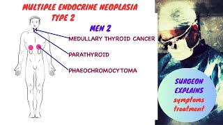 Multiple Endocrine Neoplasia  Type II MEN 2 [upl. by Nevad207]