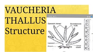 Lecture 01 VAUCHERIA Thallus Structure [upl. by Asirehc887]