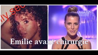 EMILIE SS9 AVANT CHIRURGIE [upl. by Avon]