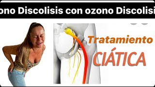 Ciatica y ozonoterapia [upl. by Connor]