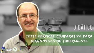 Teste cervical comparativo para diagnóstico de tuberculose [upl. by Lauritz]