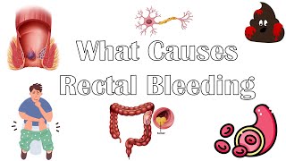 What Causes Per Rectal Bleeding Major Causes Of Blood In Stools Rectal Bleeding Causes [upl. by Ettecul523]