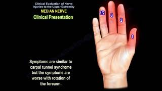 Median nerve injury causes symptoms diagnosis and treatment Carpal tunnel syndrome diagnosis [upl. by Aimaj]