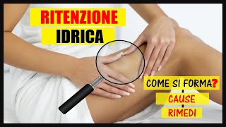 Ritenzione idrica cosè Come si forma Quali sono le cause e i rimedi [upl. by Aihsema]