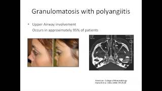 ANCA Vasculitis A Rheumatologists Perspective by Padmapriya Sivaraman MD [upl. by Oisinoid132]