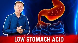 The Best Way To Know If You Have Low Stomach Acid – DrBerg [upl. by Euqinu]