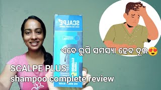 scalpe plus shampoo  scalpe plus shampoo review shortsofmonali [upl. by Cir]