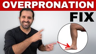 4 Exercises To Correct Overpronation In Runners To Prevent Injury [upl. by Zetnod]