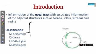 OPHTHALMOLOGY LECTURES diseases of uveal tract UVEITIS [upl. by Wilder688]