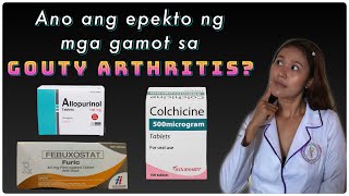 GOUTY ARTHRITIS TREATMENT TAGALOG  Gamot sa Uric Acid Febuxostat Cholchicine Allopurinol Tagalog [upl. by Boonie441]