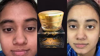 चेहरे से scars और Wrinkles को दूर करे  Vita Glow Advance skin Whitening Night Cream review [upl. by Libenson]