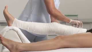 Plaster of Paris Knee Circular Cast Application [upl. by Allez173]