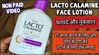 Lacto Calamine Face Lotion लैक्टो कैलामाइन लोशन  How to use lacto calamine lotion Review In Hindi [upl. by Ancier]