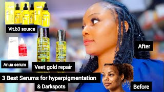 BEST FACE SERUMS FOR A GLOWING SKIN HOW TO CLEAR HYPERPIGMENTATION QUICKLY  FACE amp BODY TREATMENT [upl. by Wadell]