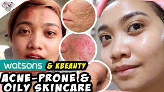 EFFECTIVE NA ANTI ACNE amp OILY SKIN CARE  DRUGSTORE amp KBEAUTY SKIN CARE  SKINCARE INGREDIENTS [upl. by Evalyn]