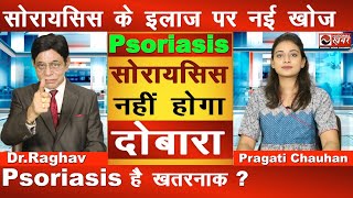 Psoriasis नहीं होगा दोबारा  सोरायसिस के इलाज पर नई खोज  Dr Raghav Heal Max Clinic National Khabar [upl. by Cirillo987]