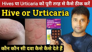 Urticaria treatment in hindi  Skin infection treatment  Hive treatment  Atarax Tablets uses [upl. by Yentnuoc508]