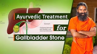 Ayurvedic Treatment for Gallbladder Stone  Swami Ramdev [upl. by Ttcos]