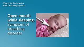 Sleep apnea  Obstructive Sleep Apnea OSA in Children Symptoms diagnosis and treatment [upl. by Kabab]