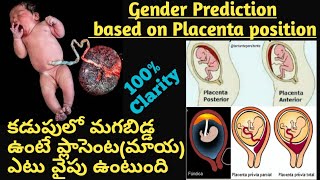 Baby Gender Prediction by Placenta II Placenta positions during pregnancyII Posterior means baby boy [upl. by Primo]