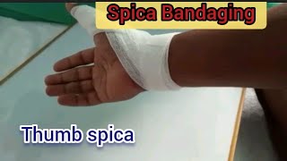 Spica BandageThumb spicaTypes of bandage [upl. by Romelle988]