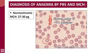 Hematology  1  U5L6  Morphological classification of anaemia by MCV  2 [upl. by Quillon635]