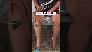 Knee Jerk Reflex L3L4 there is exaggerated extension of the left knee knee reflexes reels [upl. by Tsnre795]