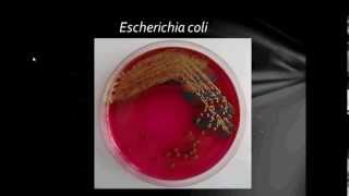 Bacteriology Gram Negative Bacilli Part1 [upl. by Corson]