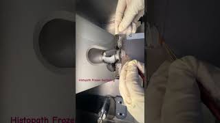 histopathology  epithelialtissue histopathology machine tissueculture patho frozensection [upl. by Adnofal508]