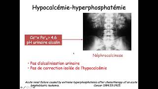 Phase socle  Urgences en Hématologie 20212022 n°22 [upl. by Inalial213]