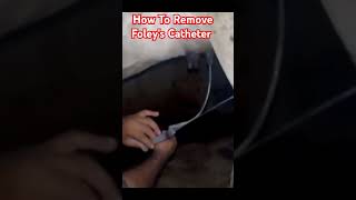 How To Remove Foleys Catheter Dr Hafiz Nadeem Ur Rehman vet viral shortsfeed [upl. by Martens275]