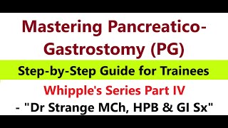 Mastering Pancreaticogastrostomy Theory amp Rationale Techniques amp Tips whippleprocedure PG [upl. by Dlaniger622]