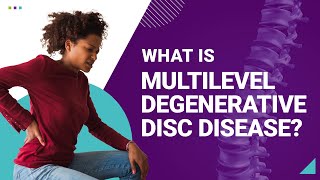 What is Multilevel Degenerative Disc Disease [upl. by Maurie612]