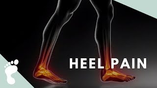 PLANTAR FACIITIS  The Most Common Heel Pain Complaint [upl. by Summers]