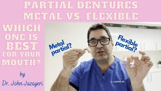 Metal Partial vs Flexible Partial Which Do You Choose [upl. by Humbert964]