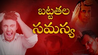 జుట్టు రాలుతోందా  Tips To Prevent Hair Fall In Telugu  Hair Loss Diet and Treatment [upl. by Yeaton968]