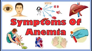 Common Signs amp Symptoms Of Anemia Iron Deficiency Hemolytic amp Other Anemias  Anemia Symptoms [upl. by Jemmy]