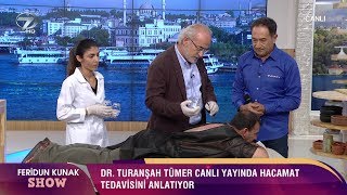 Hacamat Nasıl Yapılır Canlı Yayında Hacamat Tedavisi [upl. by Hershel]