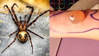 MOST Venomous Spiders On Earth [upl. by Karie]